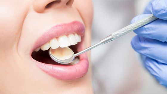 The Crucial Check-In: Why You Shouldn’t Skip Your Dental Checkups